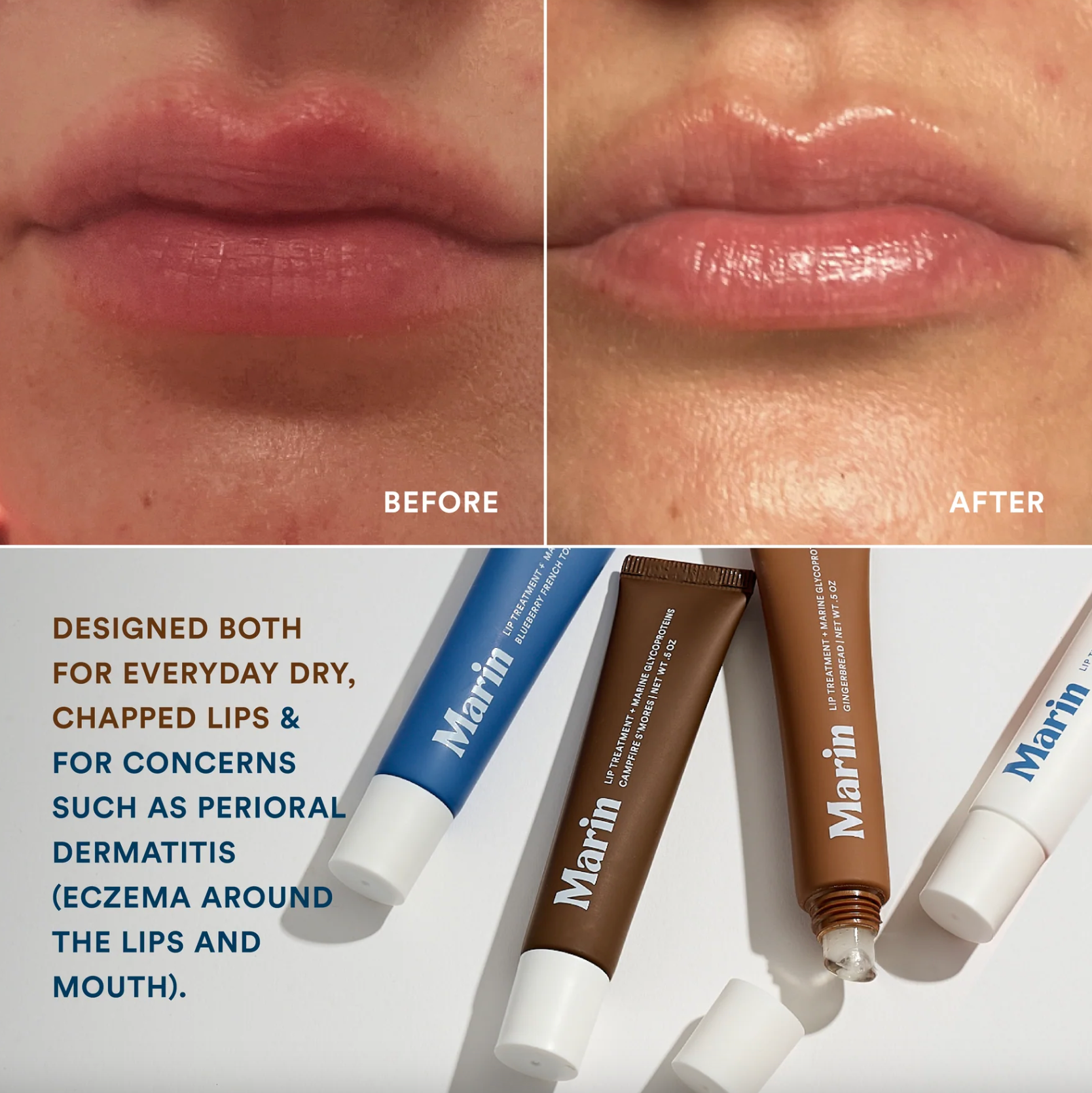 Marin Lip Treatment